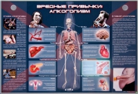 Электрифицированный стенд "Вредные привычки: алкоголизм" - «globural.ru» - Пермь