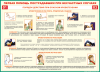 Таблица Порядок действий при опасном кровотечении 1000*1400 винил - «globural.ru» - Пермь