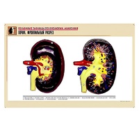 Рельефная таблица "Почка. Фронтальный разрез" (формат А1, матовое ламинир.) - «globural.ru» - Пермь